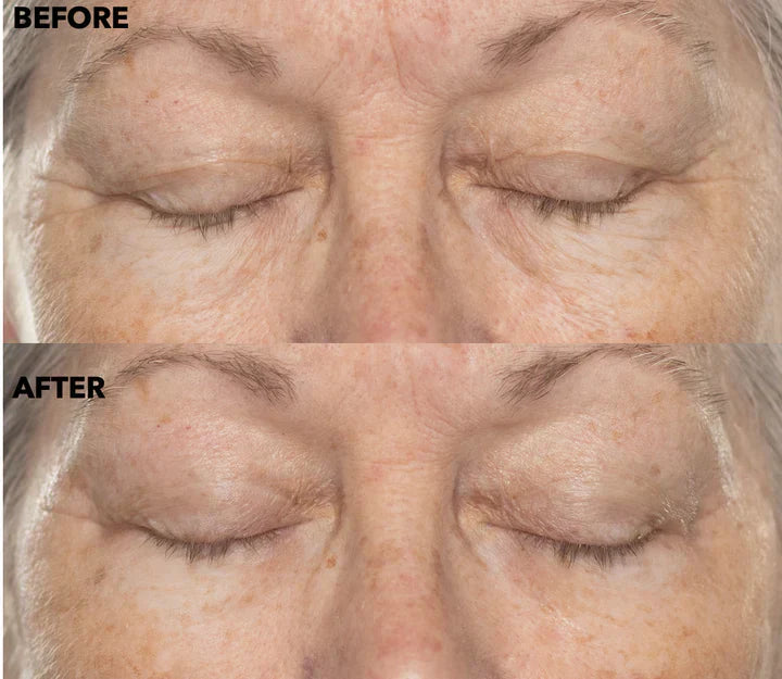 ✨Double Retinol & Collagen Peptide Serum Treatment