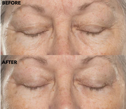 ✨Double Retinol & Collagen Peptide Serum Treatment