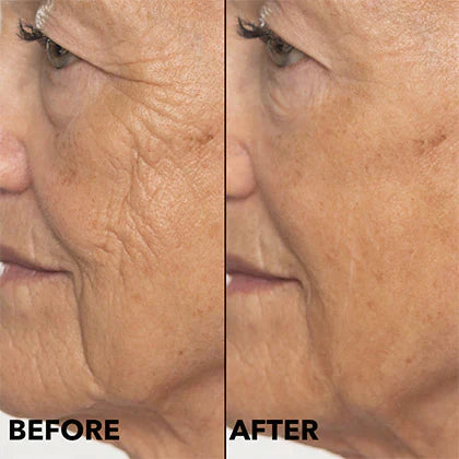 ✨Double Retinol & Collagen Peptide Serum Treatment