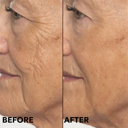 ✨Double Retinol & Collagen Peptide Serum Treatment