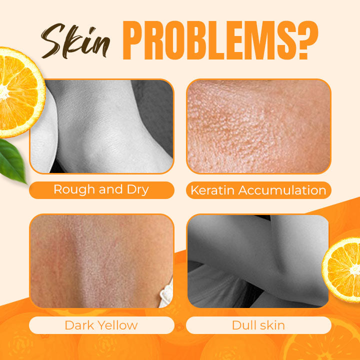 Orange Peeling Lotion