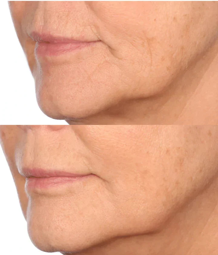 ✨Double Retinol & Collagen Peptide Serum Treatment