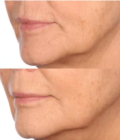 ✨Double Retinol & Collagen Peptide Serum Treatment